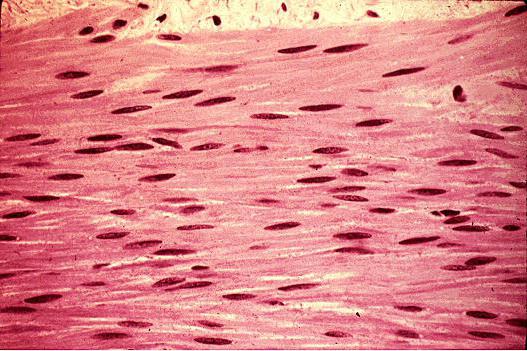 гладкое мышечное волокно