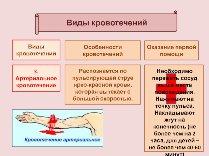 Тест определите кровотечение. Артериальное кровотечение. Артериальная кровочение. Вртериальноекровотичение.