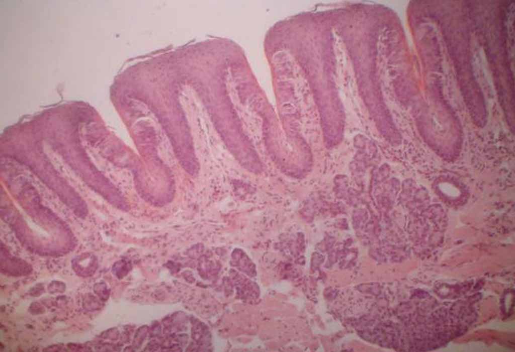 A micrograph cross-section of some of the papillae on the surface of the tongue